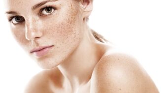 Коричневые пятна на лице: как убрать возрастную пигментацию на коже